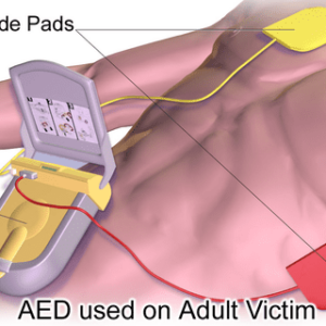 aed