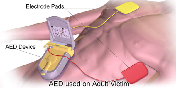 aed